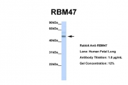ARP40932_P050 - RBM47