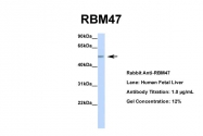 ARP40932_P050 - RBM47