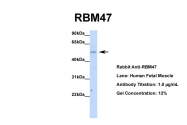 ARP40932_P050 - RBM47