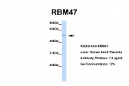 ARP40932_P050 - RBM47