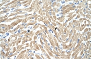 ARP41392_T100 - Tropomyosin-1 (TPM1)
