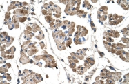 ARP41463_T100 - Alpha-actinin-2 / ACTN2