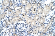 ARP41733_P050 - Cytokeratin 17