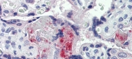 ARP41757_P050 - Prothrombin (F2)
