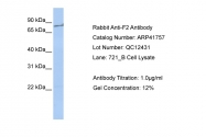 ARP41757_P050 - Prothrombin (F2)
