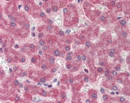 ARP41757_P050 - Prothrombin (F2)