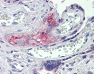 ARP41757_P050 - Prothrombin (F2)