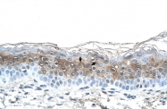 ARP41758_T100 - Fibrinogen alpha chain