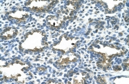 ARP41959_T100 - Alkaline phosphatase / PLAP / ALPP
