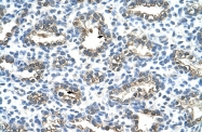 ARP42031_T100 - Cytokeratin 13