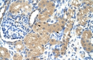 ARP42117_P050 - Skeletal muscle Troponin I