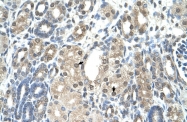ARP42255_T100 - Visfatin / NAMPT