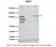 ARP43631_P050 - ABCF1