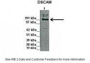 ARP45086_P050 - DSCAM