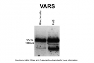 ARP46151_P050 - VARS (Valyl-tRNA synthetase)