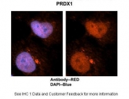 ARP48454_P050 - Peroxiredoxin-1 / PRDX1