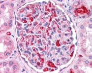 ARP54283_P050 - Apolipoprotein E / Apo E