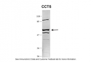 ARP54825_P050 - CCT5 / TCP1 epsilon