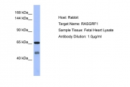 ARP56516_P050 - RASGRF1
