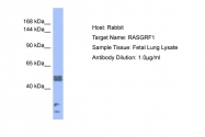 ARP56516_P050 - RASGRF1