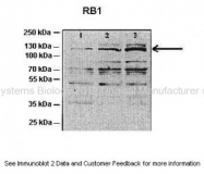 ARP58065_P050 - Retinoblastoma-associated protein / RB1
