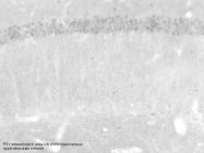 ARP58941_P050 - Presenilin-1