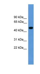 ARP58941_P050 - Presenilin-1