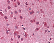 ARP59037_P050 - CD282 / TLR2