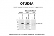 ARP59276_P050 - OTUD6A
