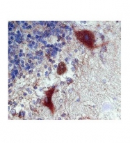 ARP60104_P050 - Calbindin