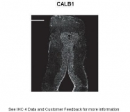 ARP60104_P050 - Calbindin