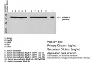 ARP60936_P050 - Calpain-1