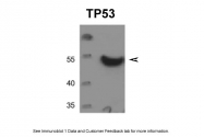 AVARP02055_T100 - TP53 / p53