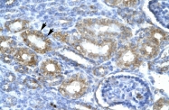 AVARP03009_P050 - CDK7
