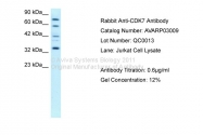 AVARP03009_T100 - CDK7
