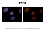 AVARP03018_T100 - PCNA