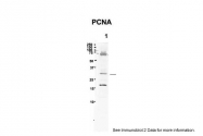 AVARP03018_T100 - PCNA