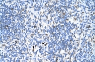 AVARP03018_T100 - PCNA