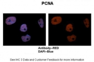 AVARP03018_T100 - PCNA