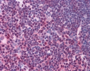 AVARP09057_P050 - STAT3