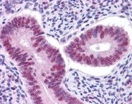 AVARP09057_P050 - STAT3