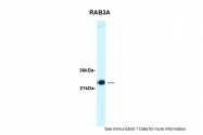 AVARP13056_T100 - RAB3A