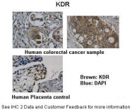 AVARP20010_P050 - CD309 / VEGFR-2 / Flk-1