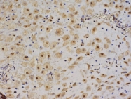 bs-0015R - Insulin-like growth factor II / IGF2