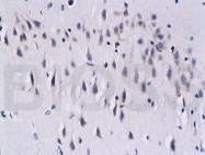 bs-0030M - PPP3CA / Calcineurin A