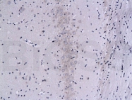 bs-0030M - PPP3CA / Calcineurin A