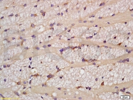 bs-0093R - TNF-beta / Lymphotoxin-alpha