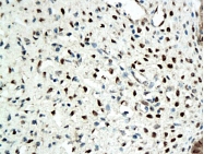 bs-0116R - Estrogen receptor beta