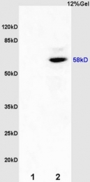 bs-0116R - Estrogen receptor beta
