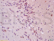 bs-0157R - 14-3-3 protein theta